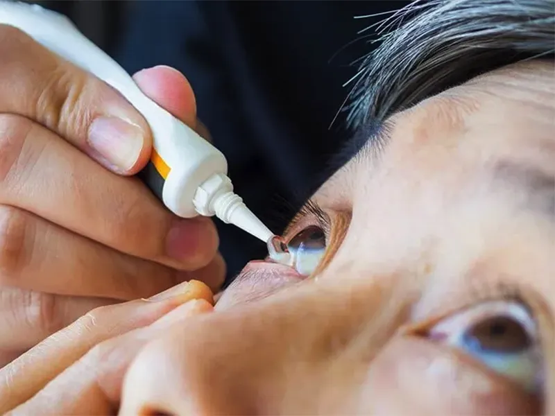 dry eye treatment